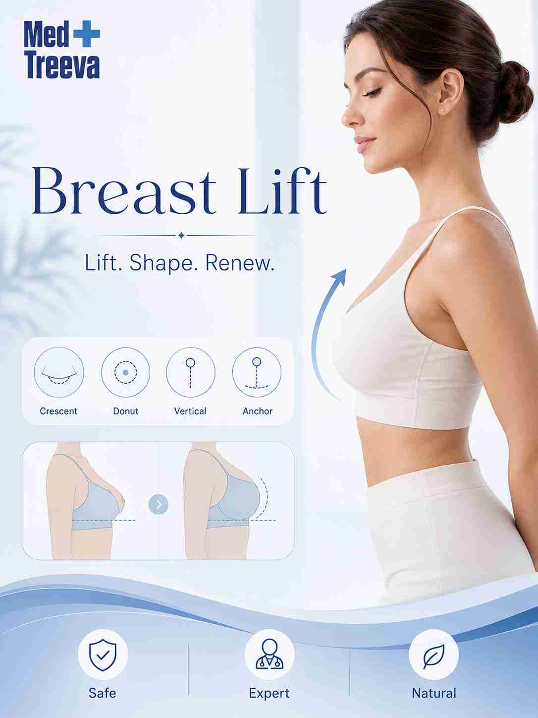 web_Breast Lift Surgery