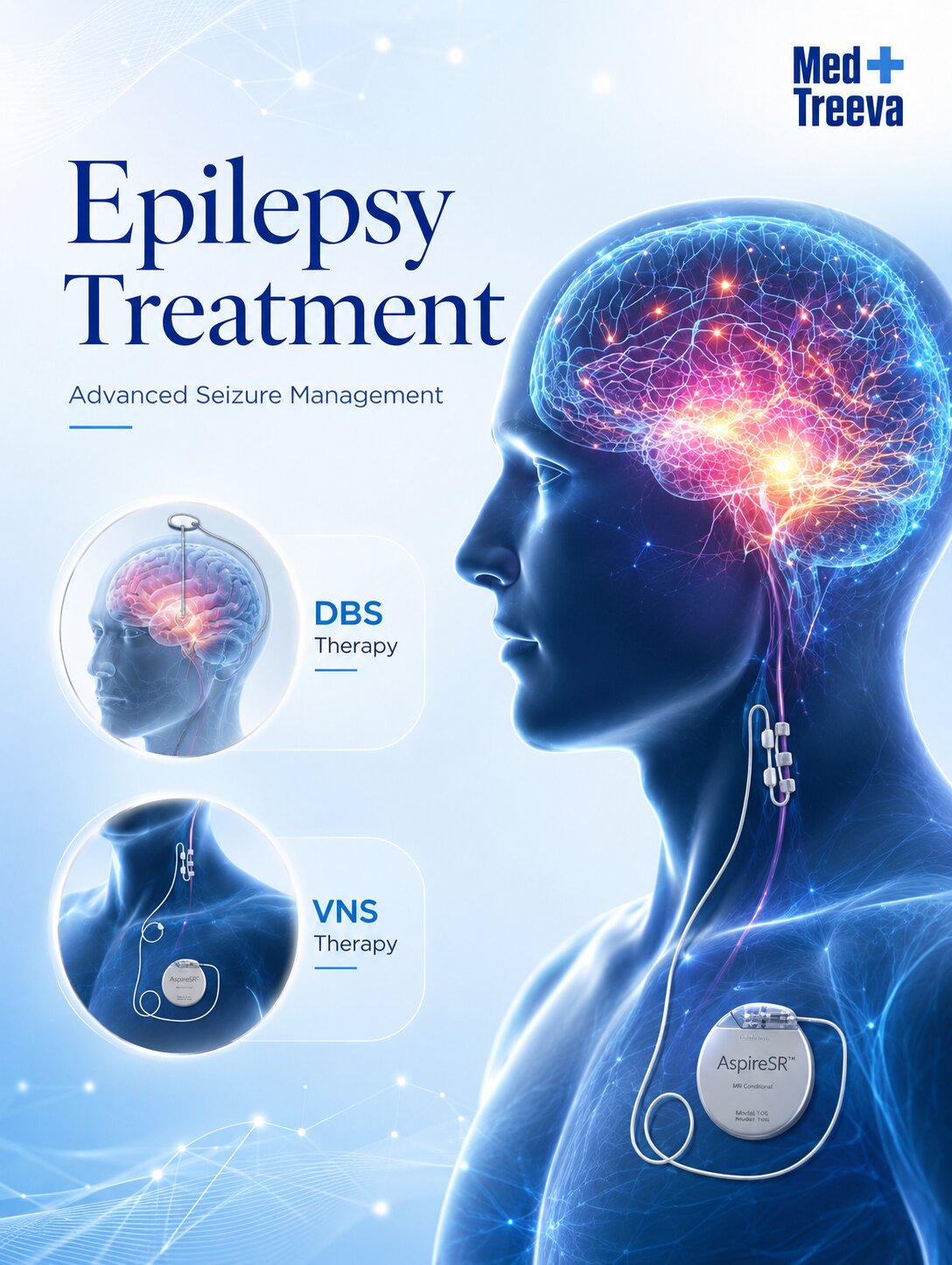 web_Epilepsy Treatment