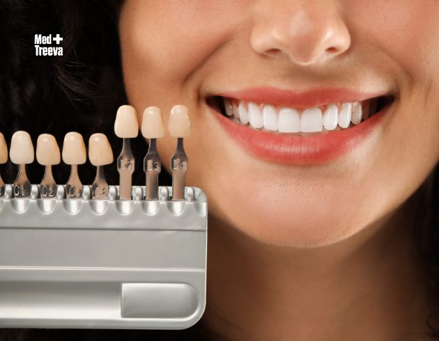 web_Step-by-Step Dental Crowns & Veneers Procedure