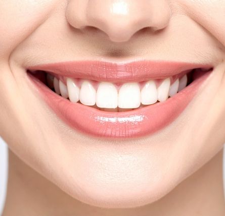web_Step-by-Step Smile Makeover Procedure in India