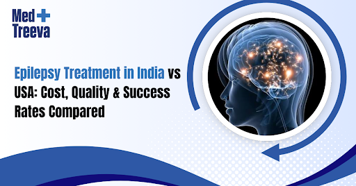 Epilepsy Treatment in India vs USA - Cost and Success Guide