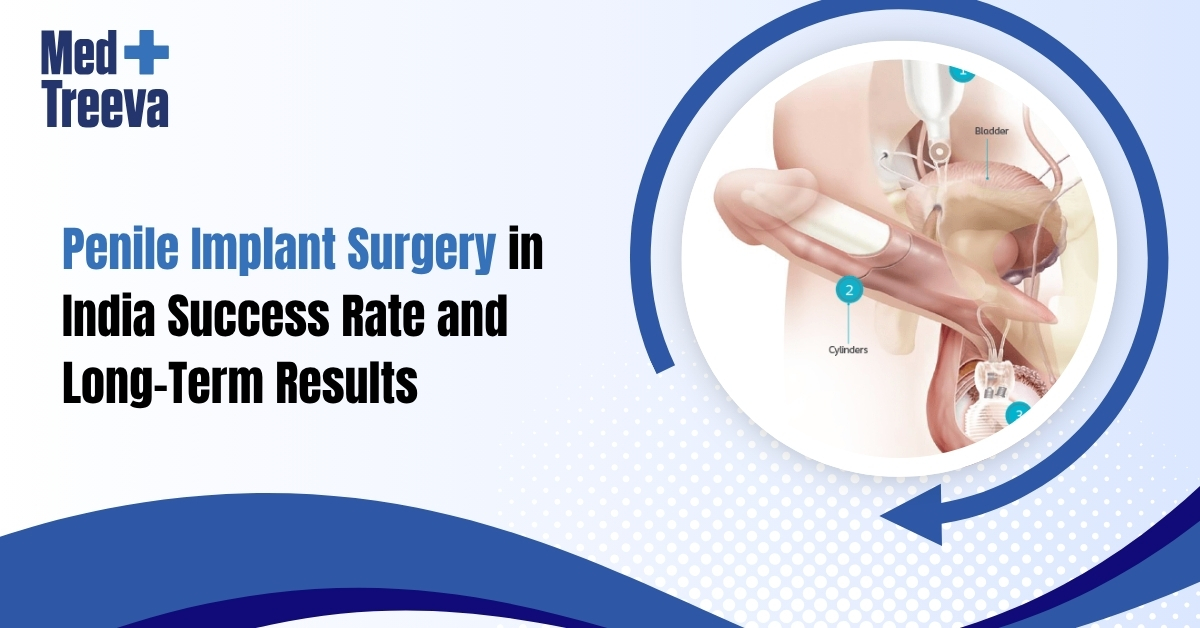 Penile Implant Surgery in India Success Rate and Results