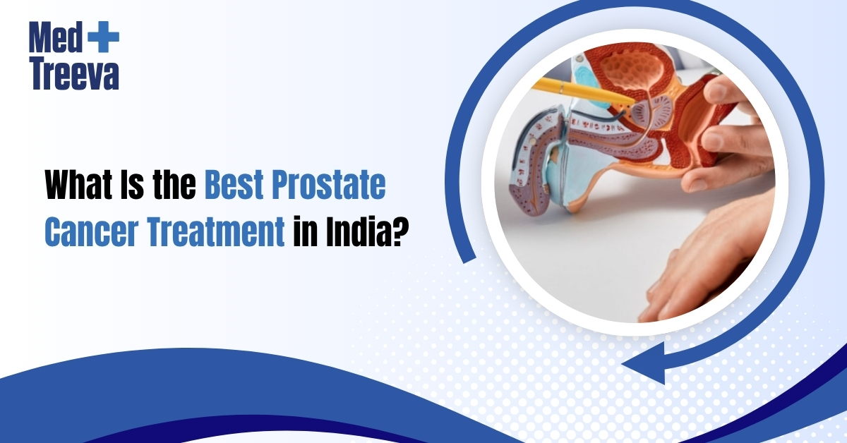 What Is the Best Prostate Cancer Treatment in India
