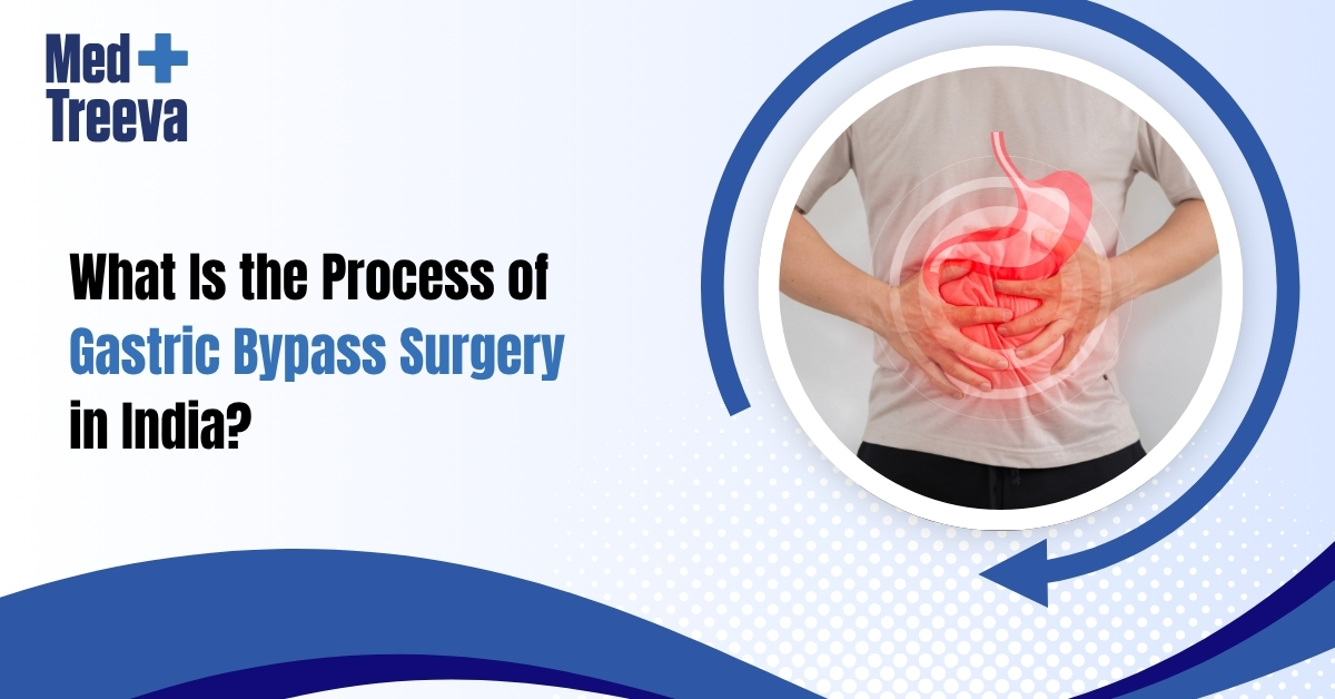 What Is the Process of Gastric Bypass Surgery in India