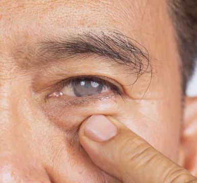 All-Inclusive Cataract Surgery Package in India