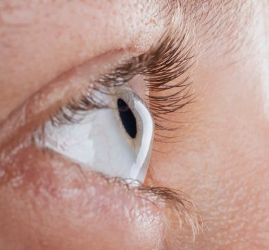 All-Inclusive Keratoconus Treatment Package in India